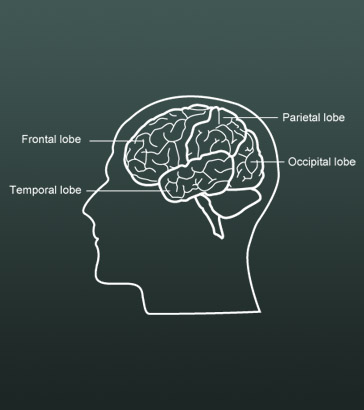 The human brain