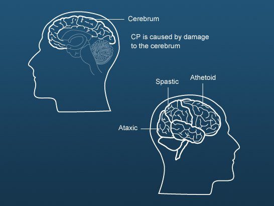 Cerebellum