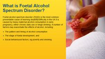 Foetal Alcohol Spectrum Disorder