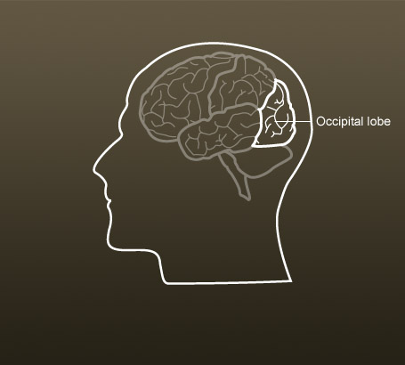 Occipital lobe