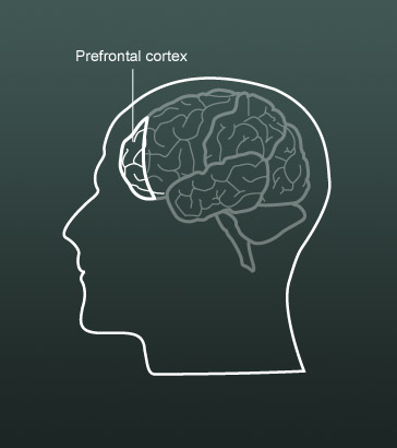 Diagram of the human brain.